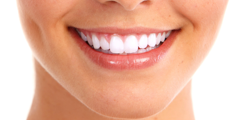 Cosmetic Dental Treatments at PERFECT SMILE